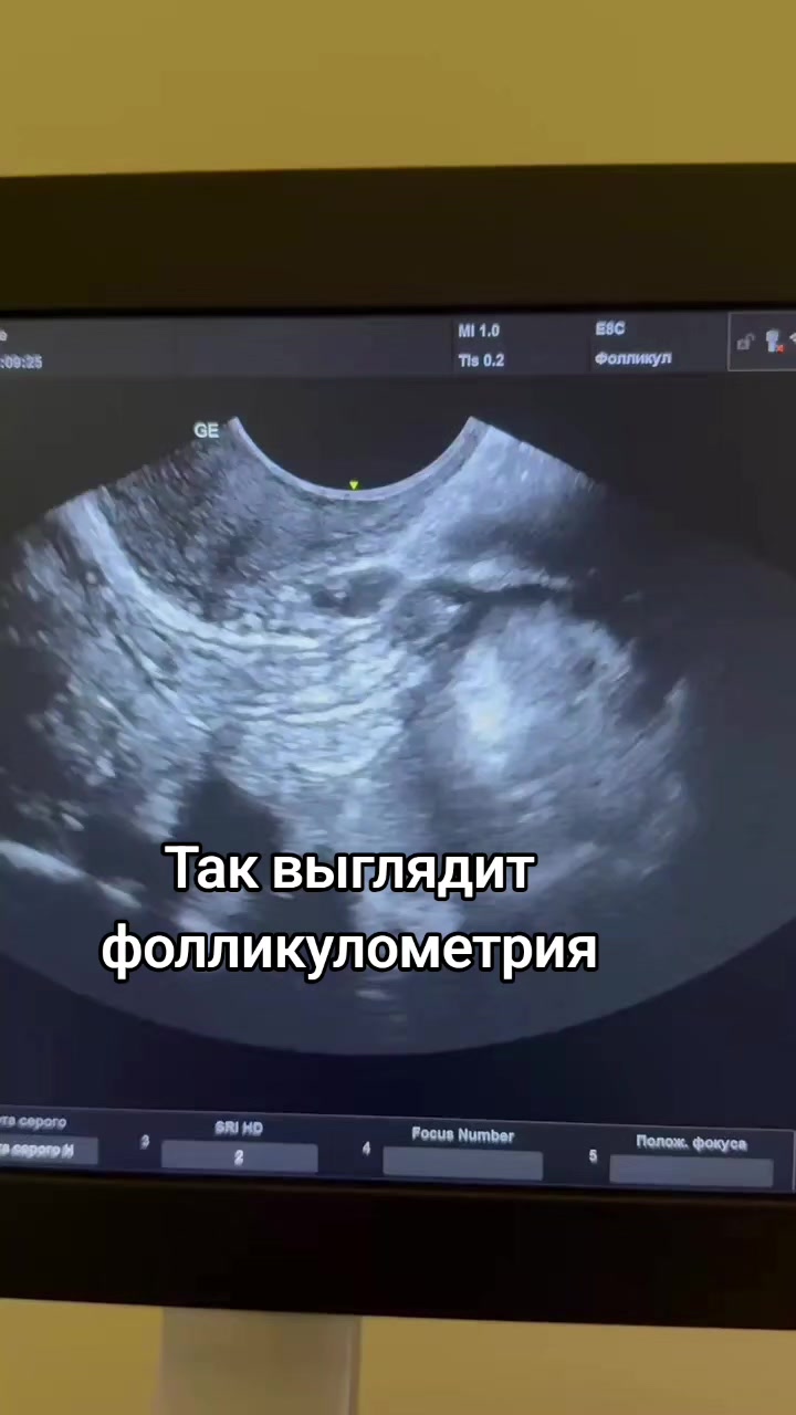 @Donor & Surrogacy | Georgia