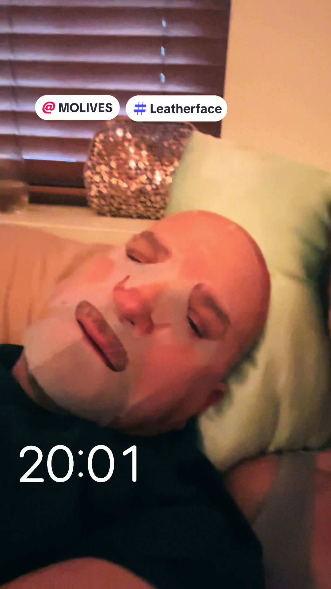 @SurgicalOncologyRN-11:11
