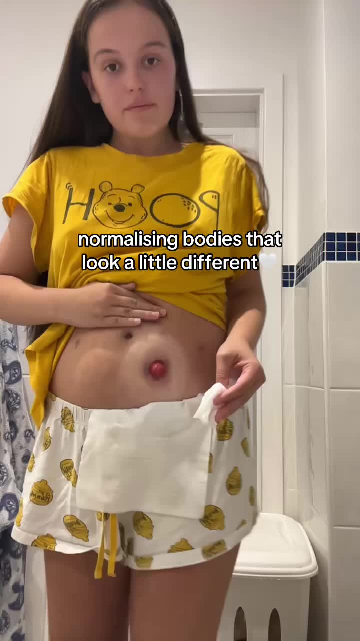 @tonisbrokenbladder