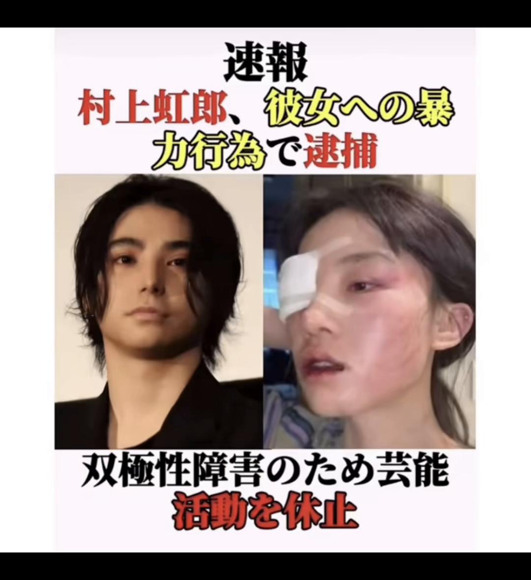 @Atsushiโท ๐ผ๐ช๐ ๐ซ๐ฝ๐ผ โจ