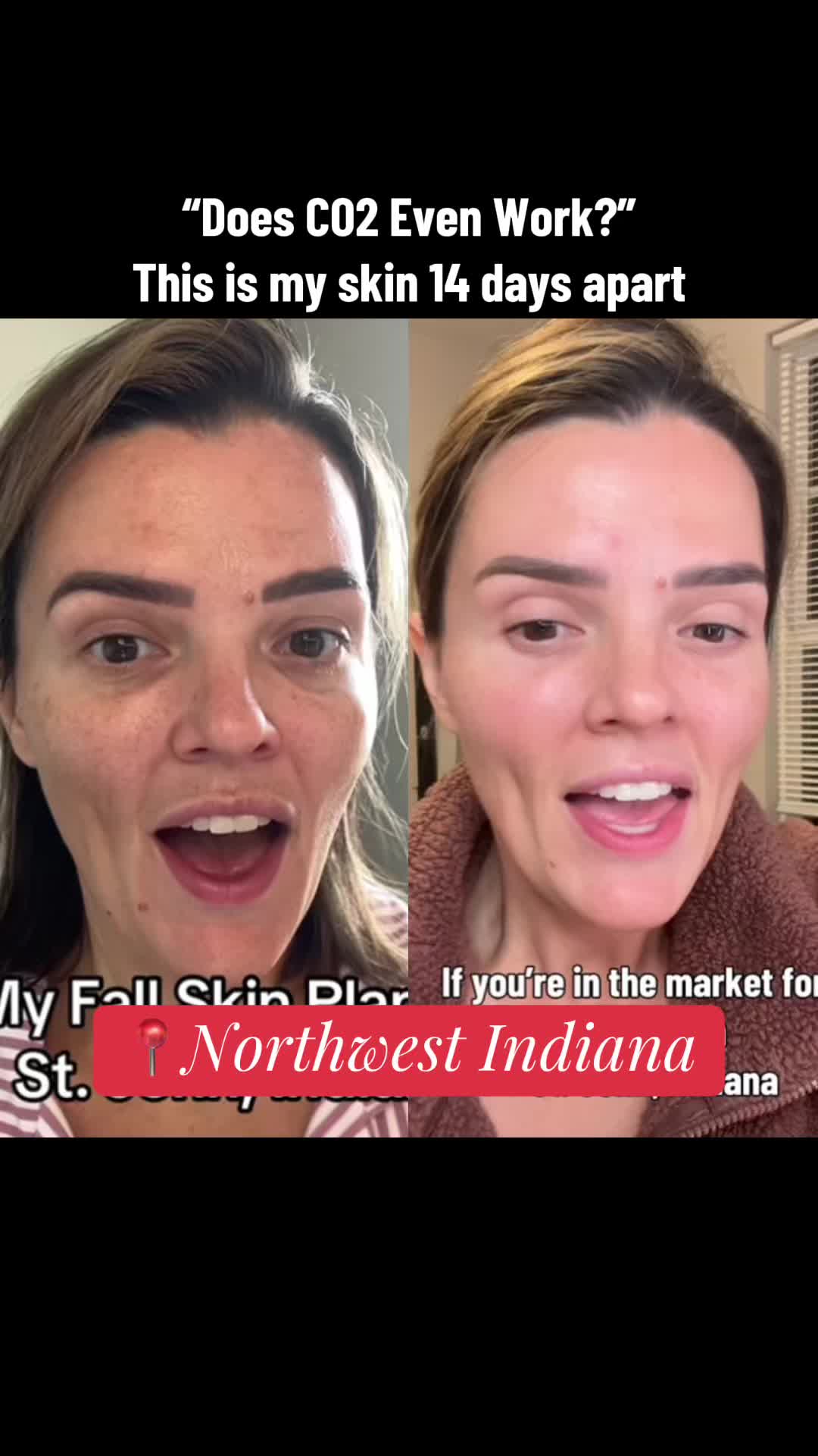 @Christy - NWI Aesthetic NP