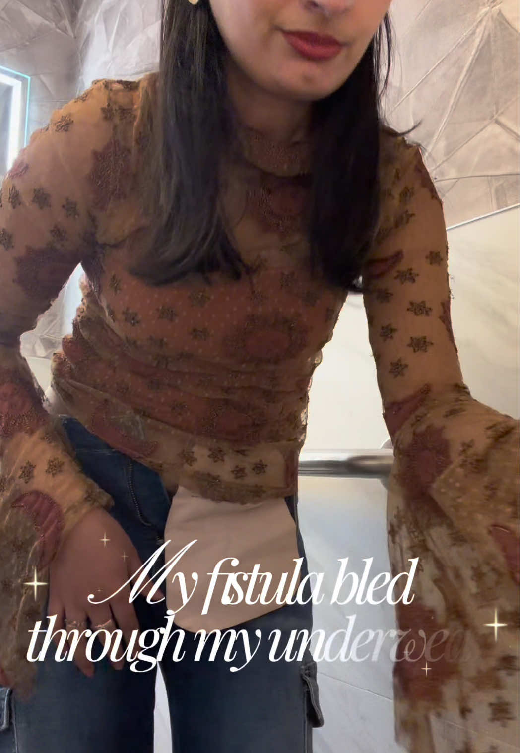 @ostomate