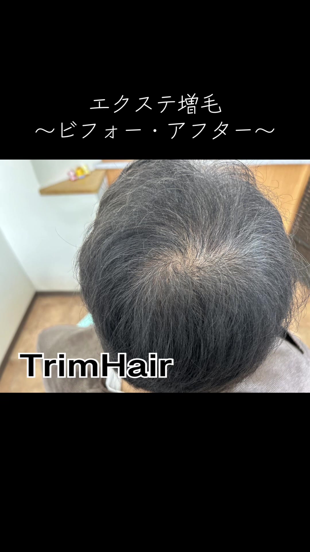 @Trim Hair