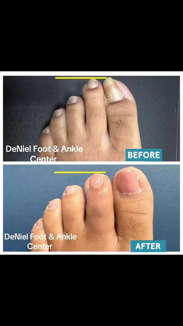 @Deniel Foot and Ankle Center