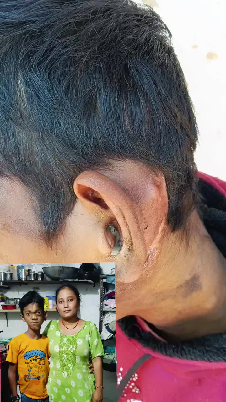 @sanugorkha
