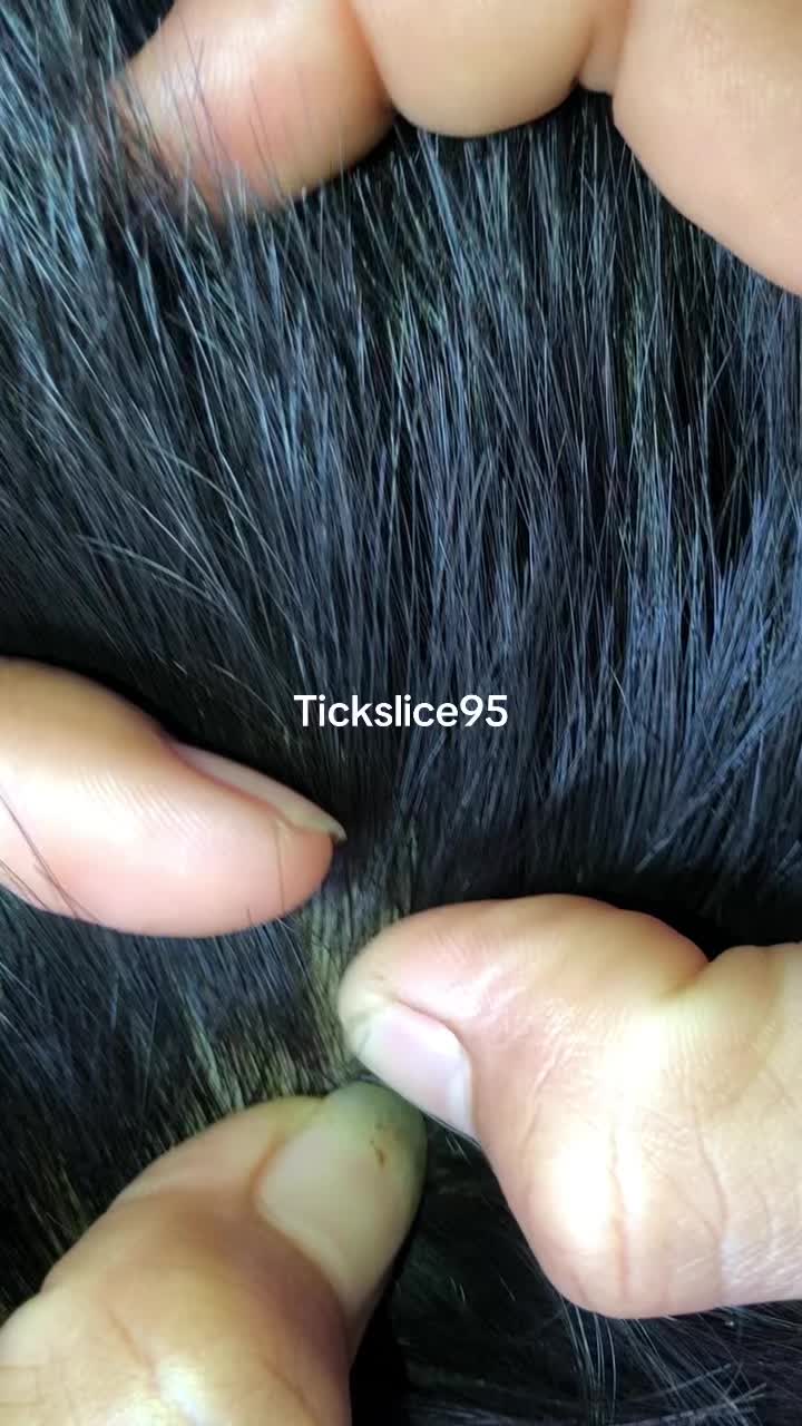 @Tickslice95