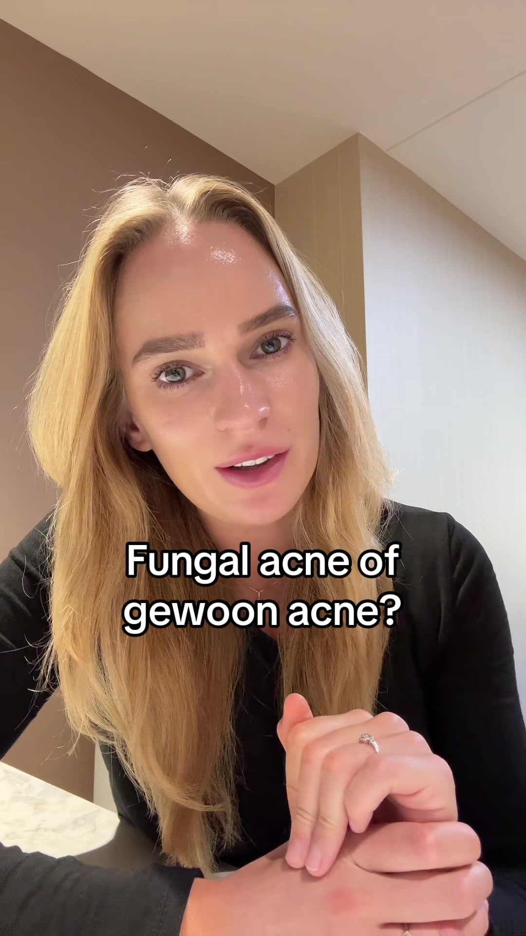 @Skinfixer