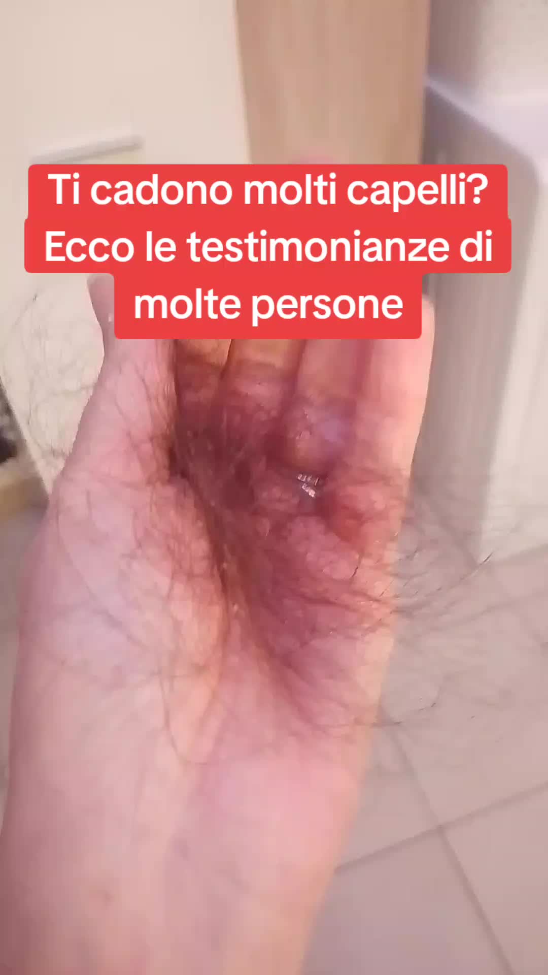 @iry crescita capelli