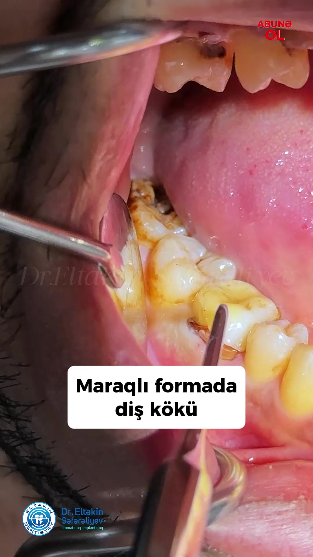 @eltakindentistry