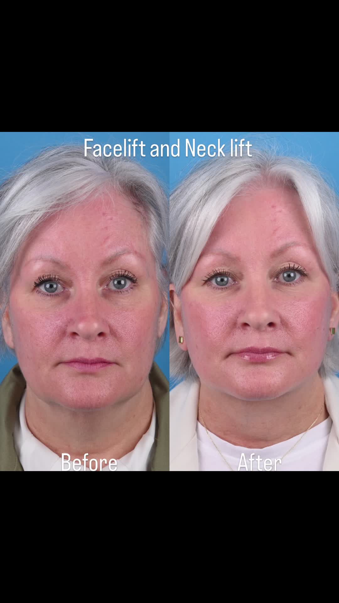 @Dr. Parit Patel, MD