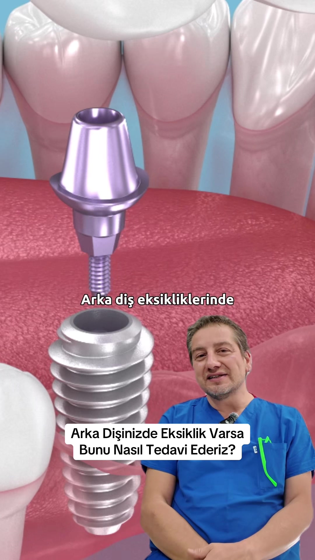 @Dr. Can Yemenicioğlu