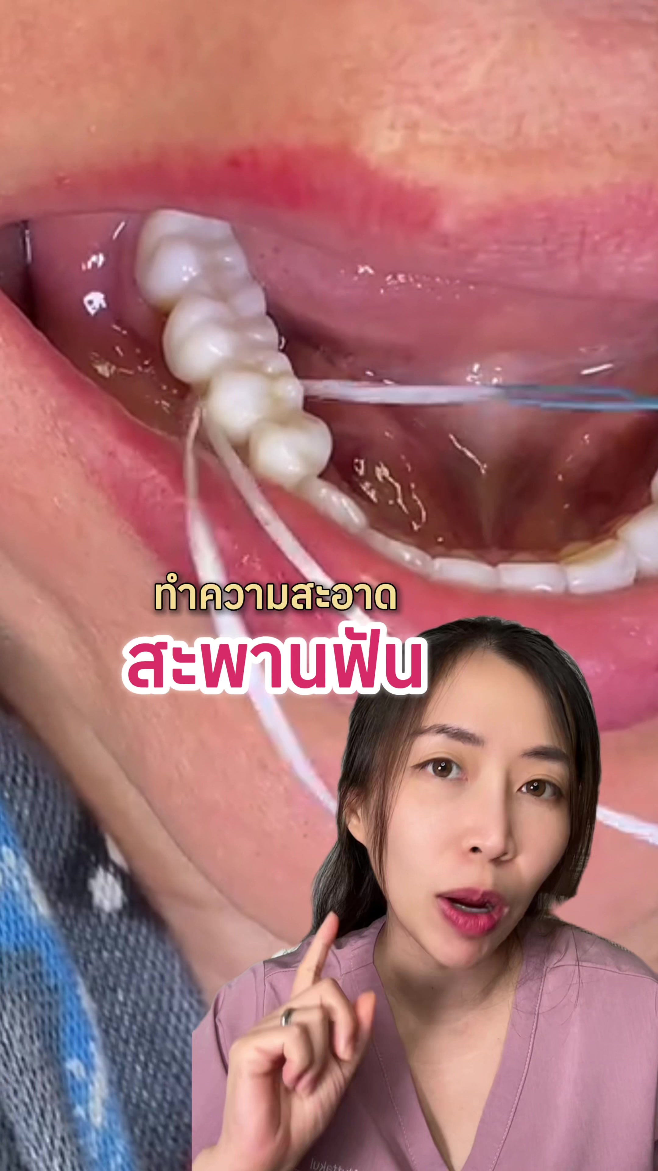 @ณัฐคุณ (Nuttakul Dent) 🦷