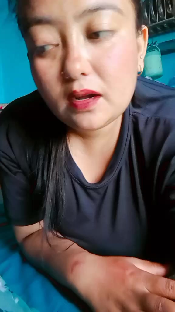 @champa