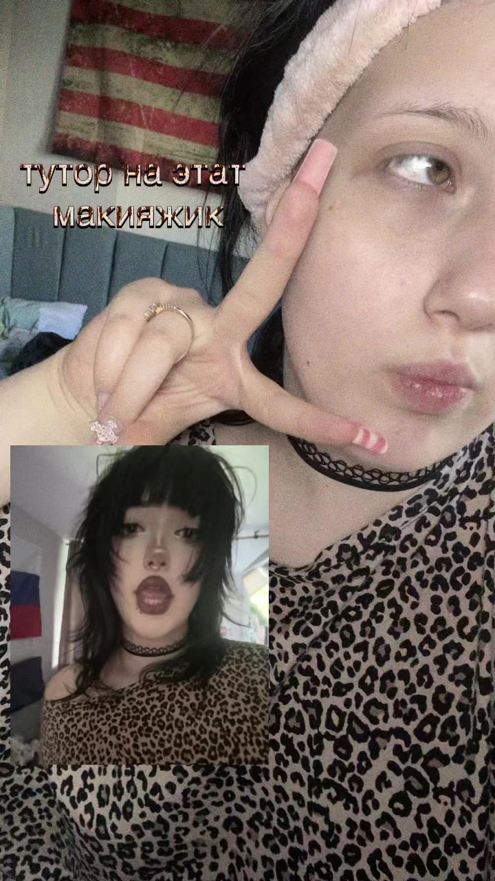 @xilo