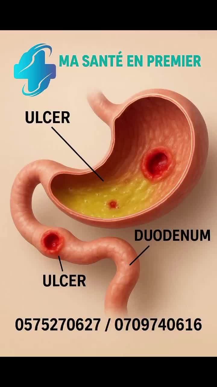 @MA SANT&Eacute; EN PREMIER
