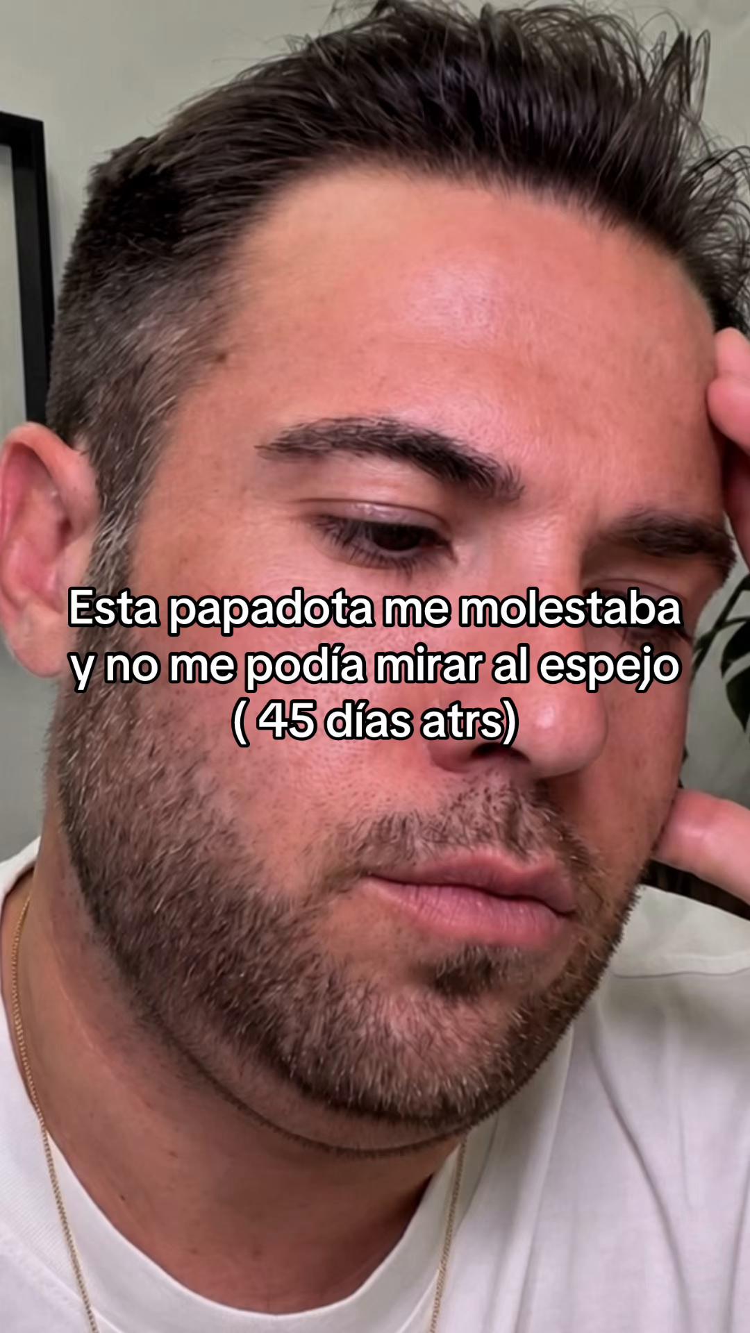 @Andrea