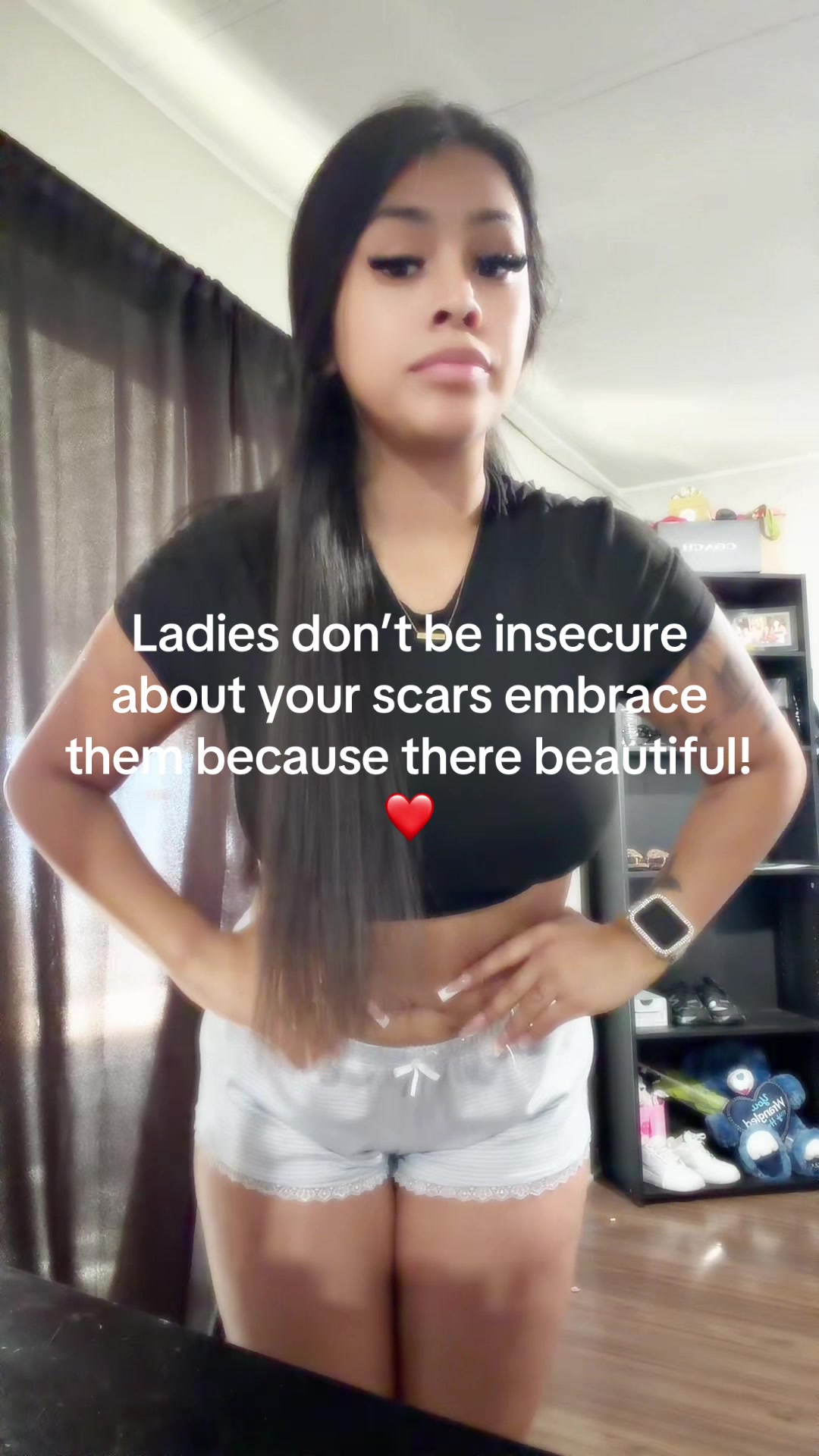 @Suzzy Nunez