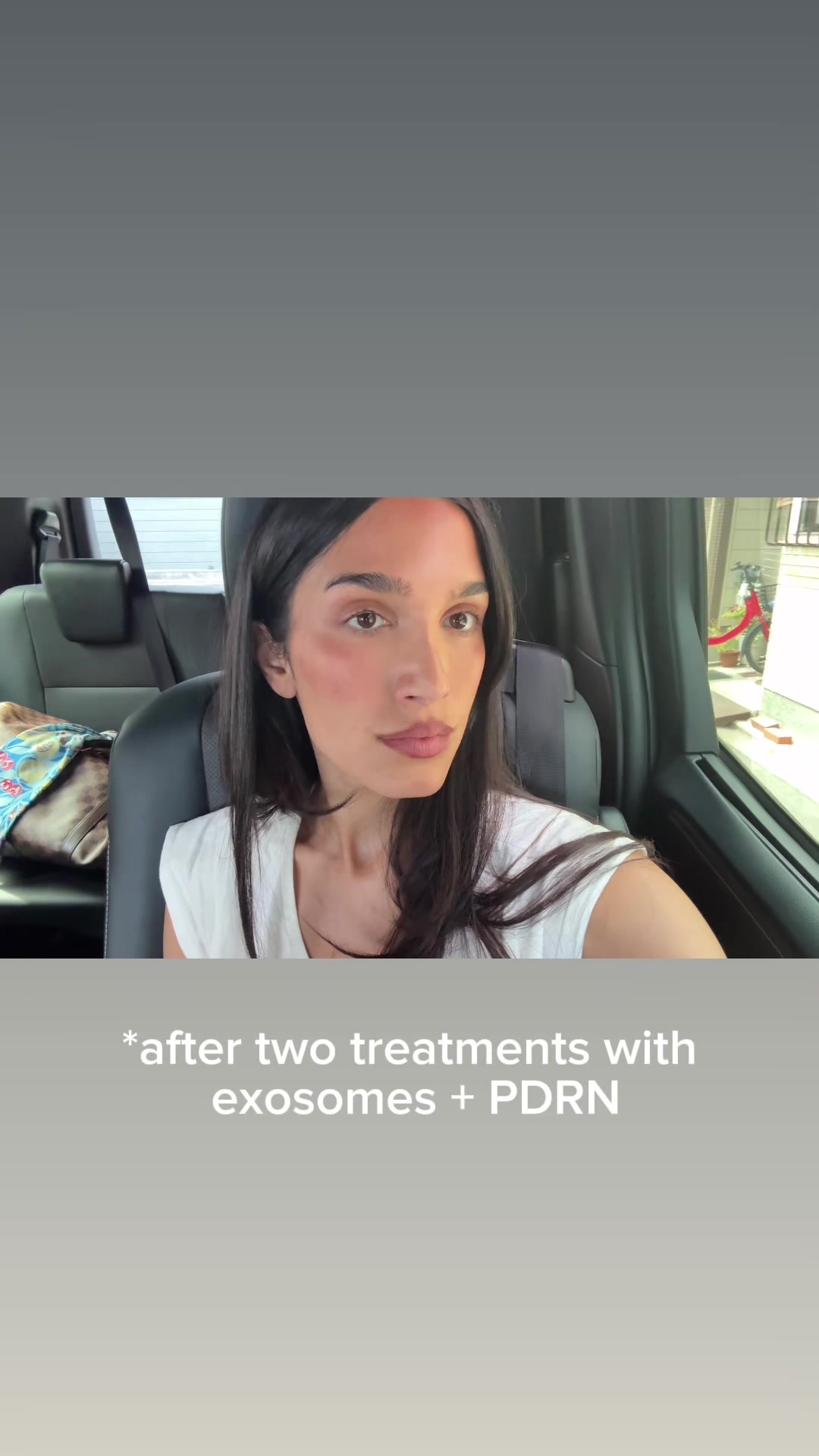 @Ro 🎀