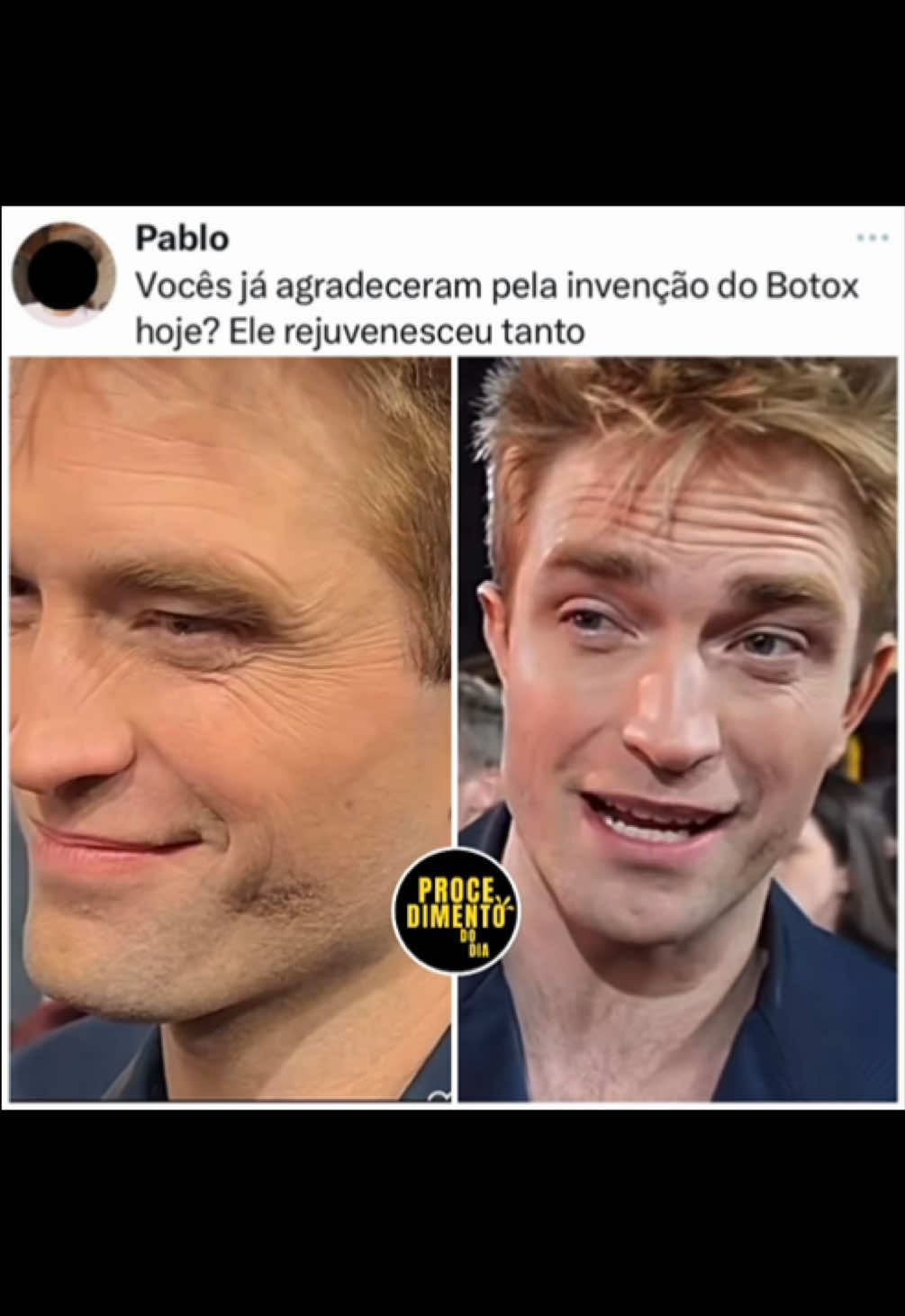 @procedimentododia