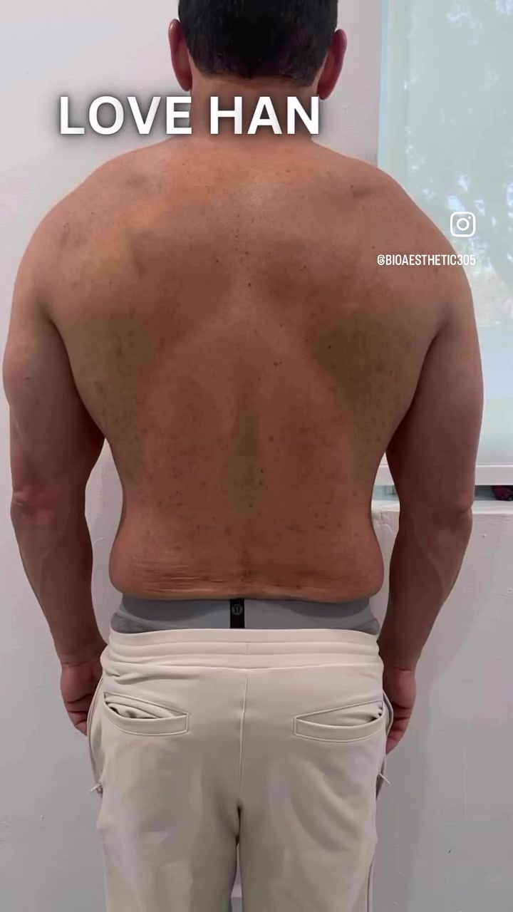 @BioAesthetic305