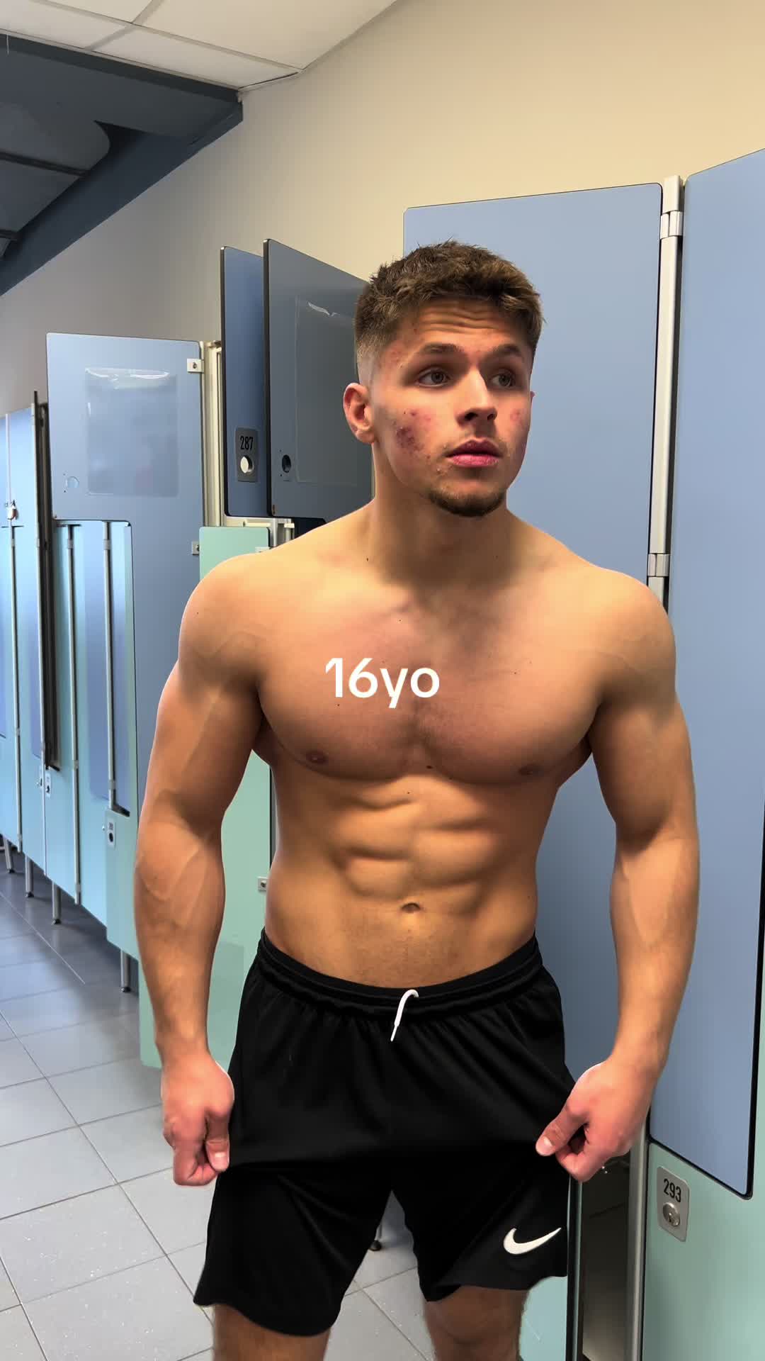 @edijon krasniqi