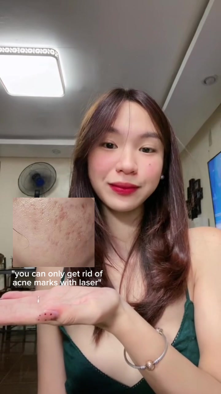 @chesca