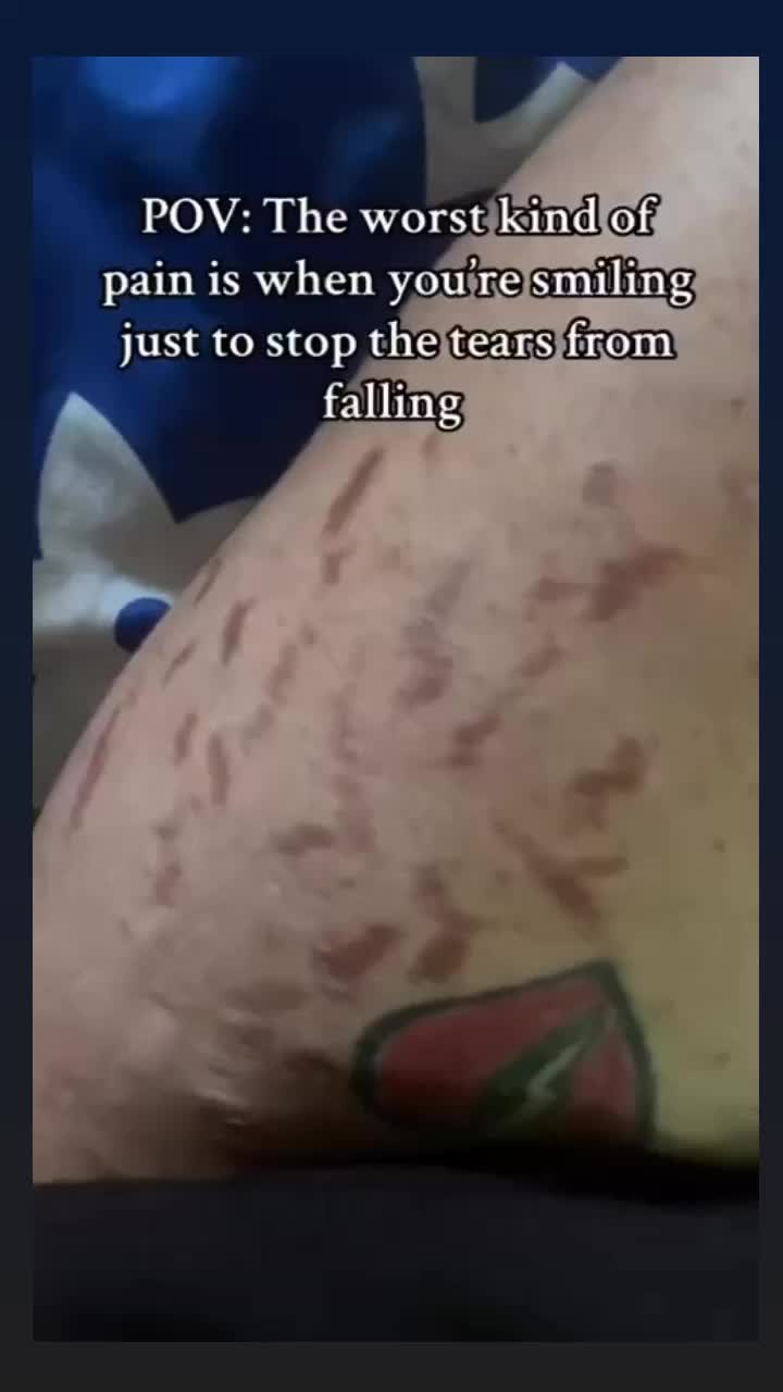@Stretch_markeraser