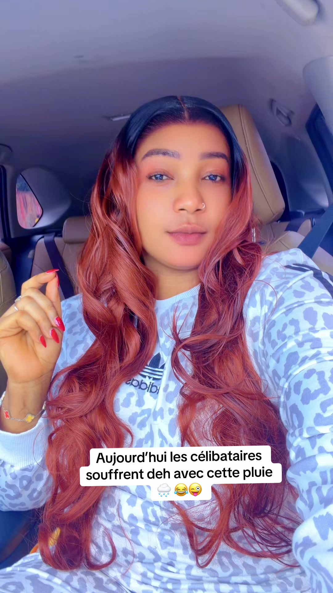 @Chic teint 🧴 🧼 224🇬🇳