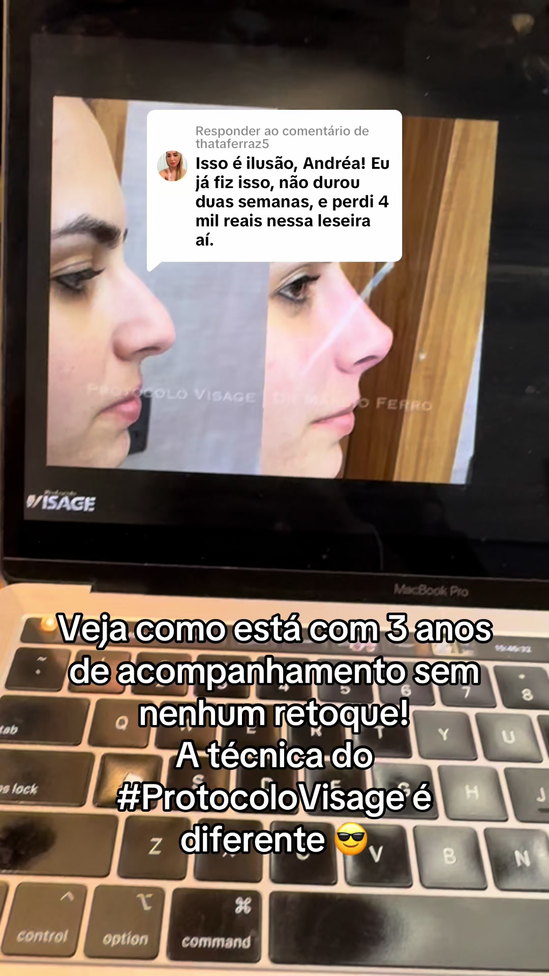 @Márcio Ferro