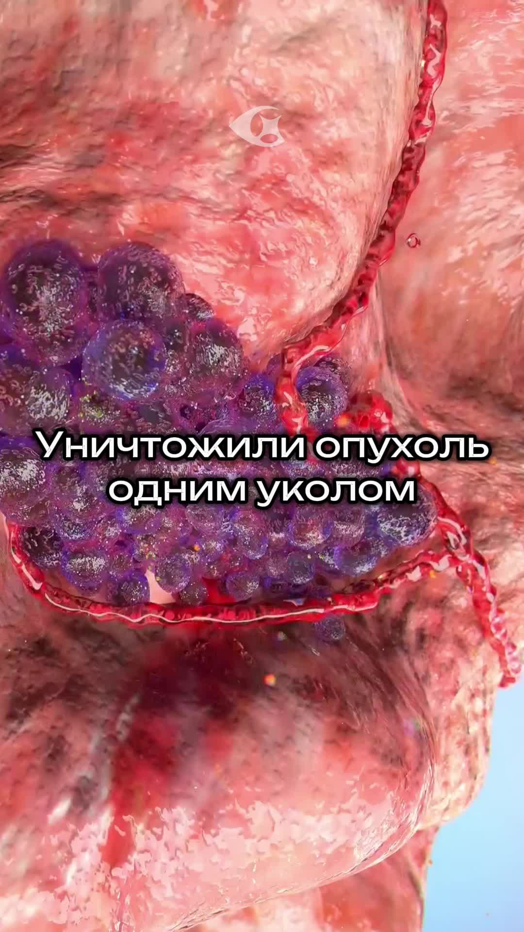 @Curiosity vision