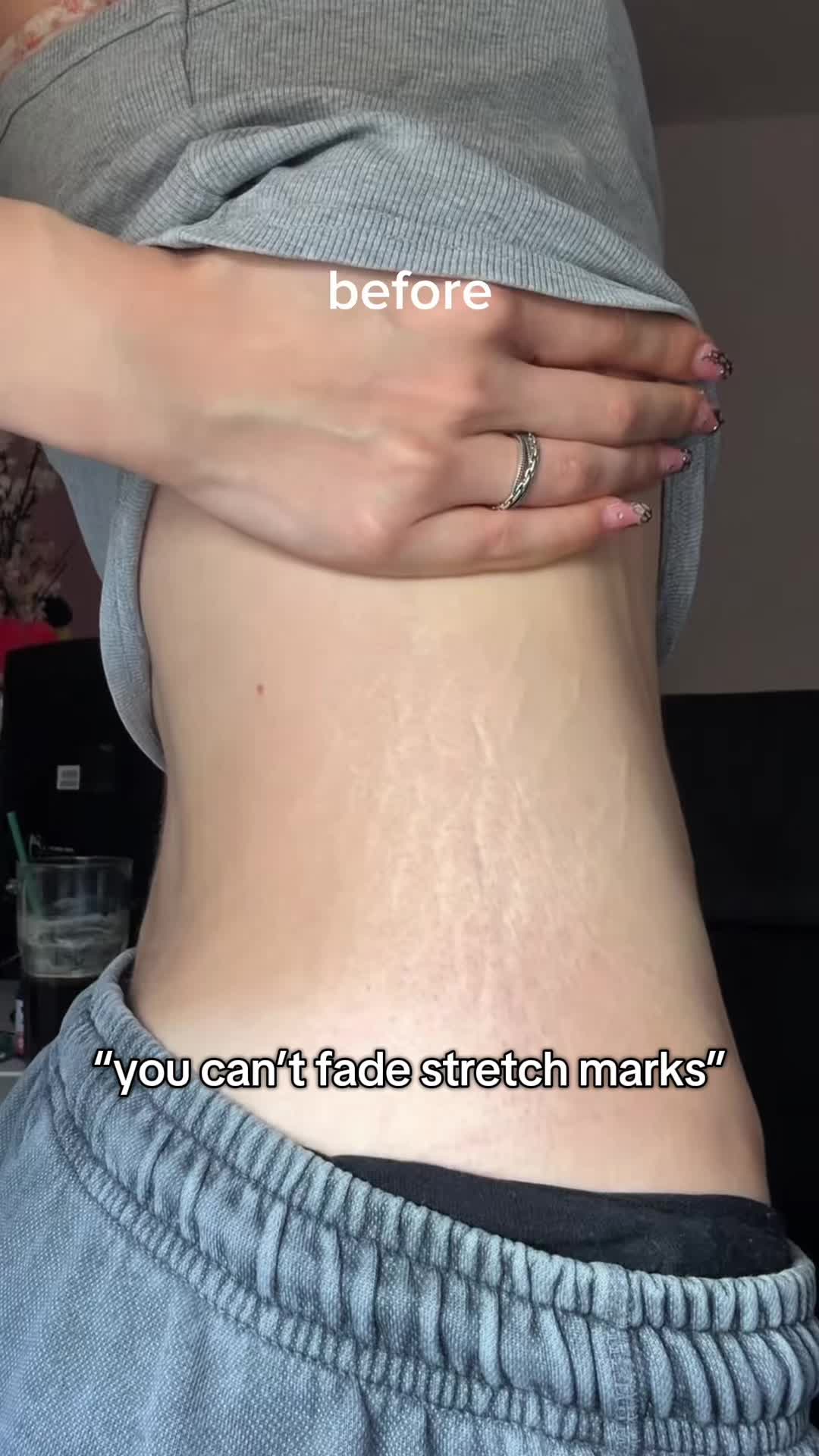 @Laura