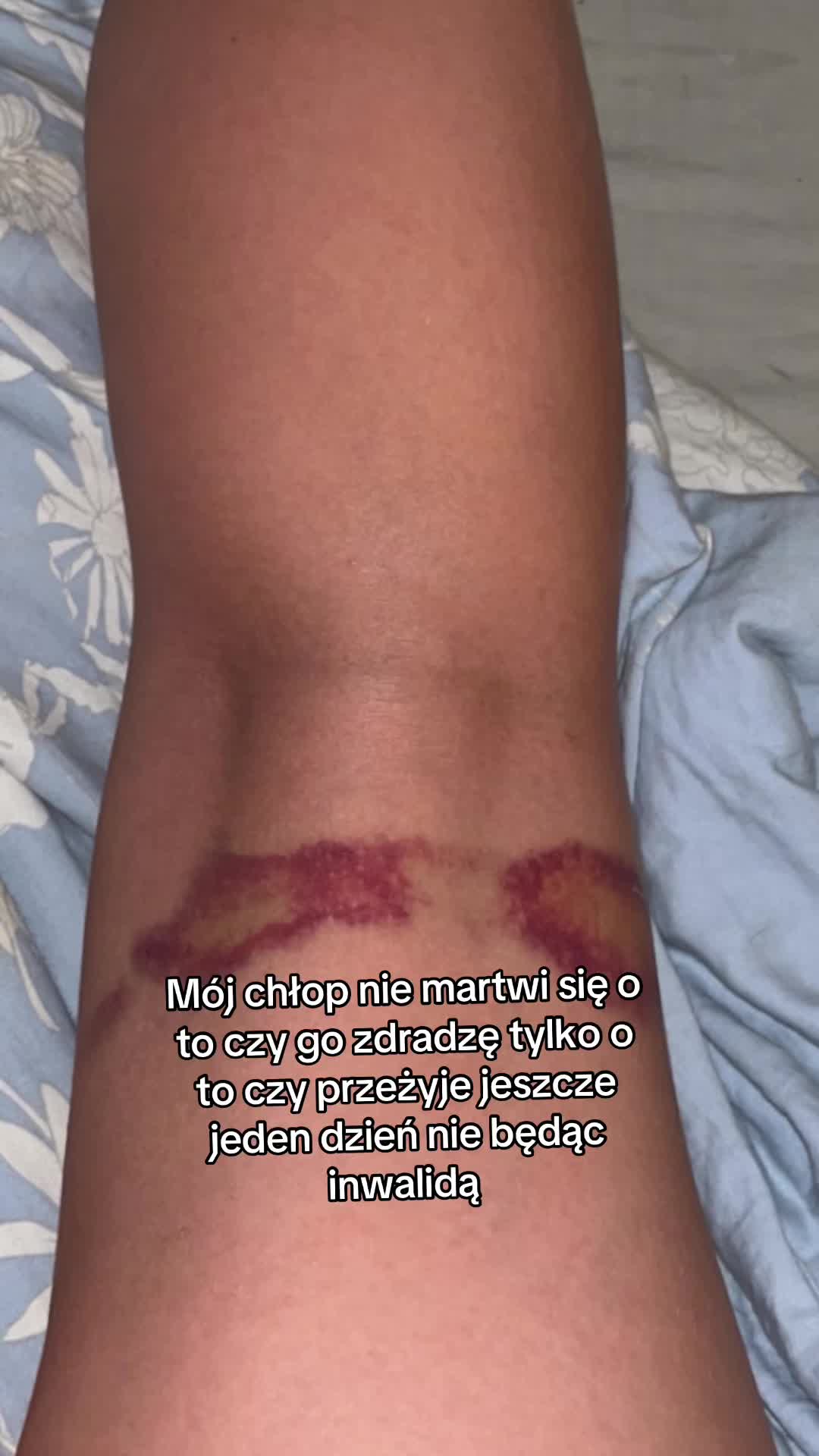 @💟