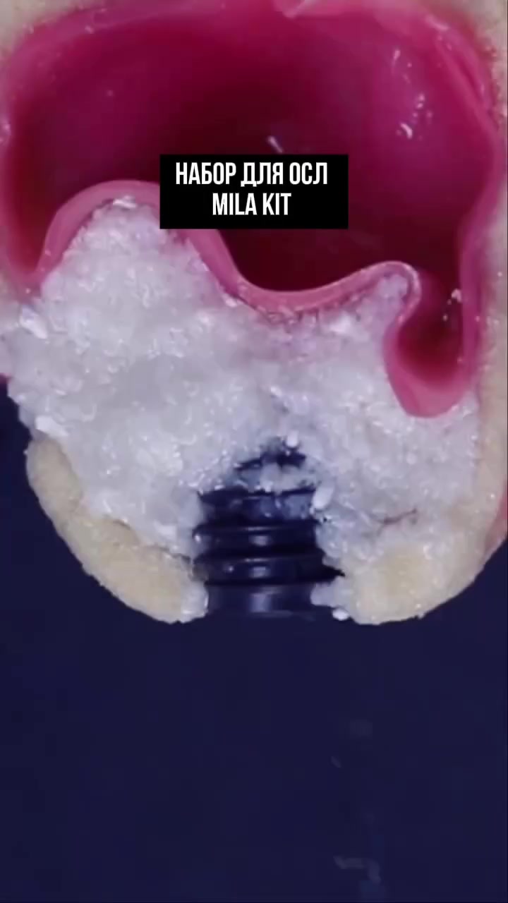 @Dent_tooth