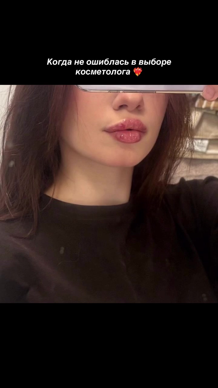 @КОСМЕТОЛОГ &bull; УВЕЛИЧЕНИЕ ГУБ