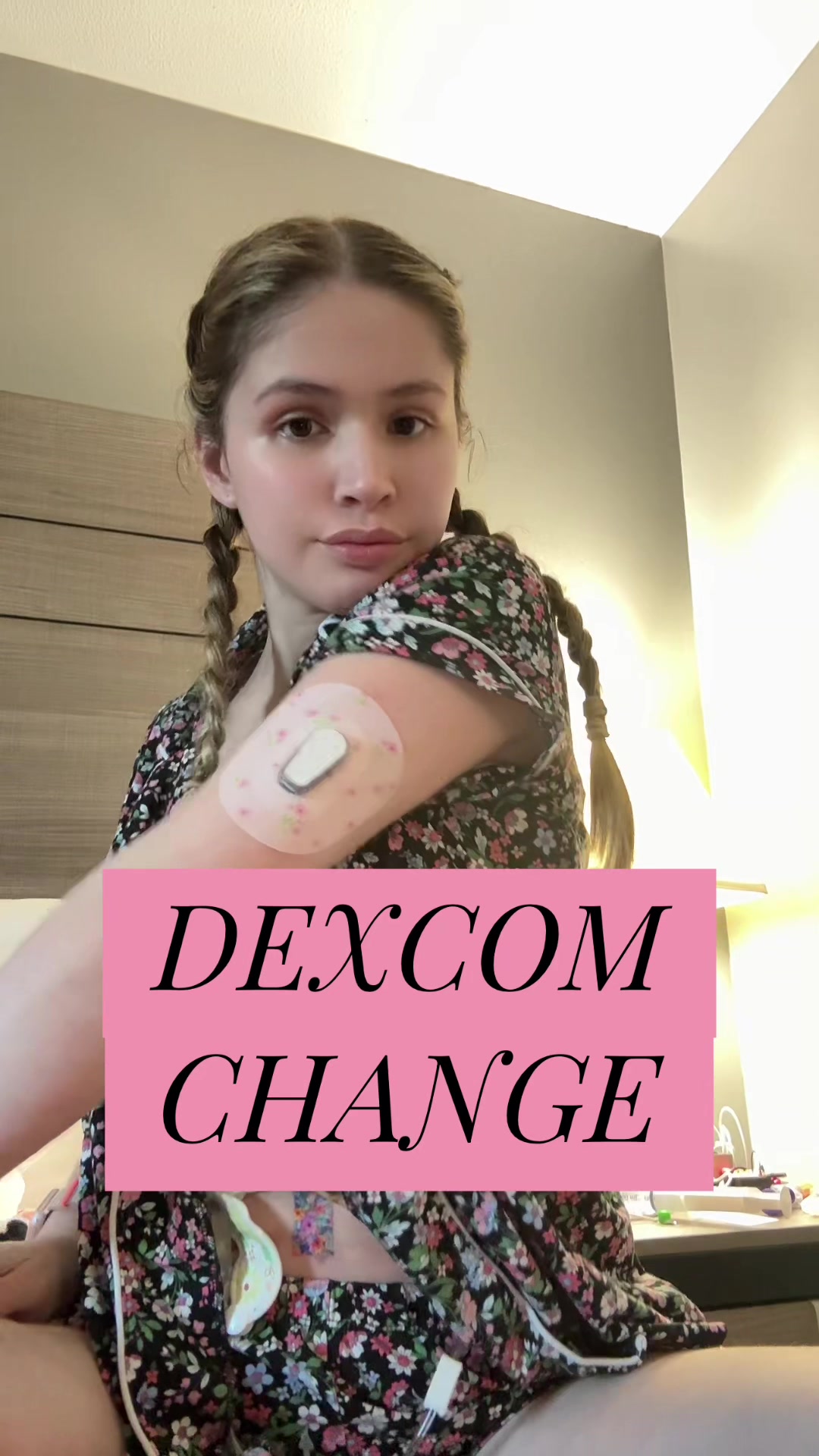 @Alexa