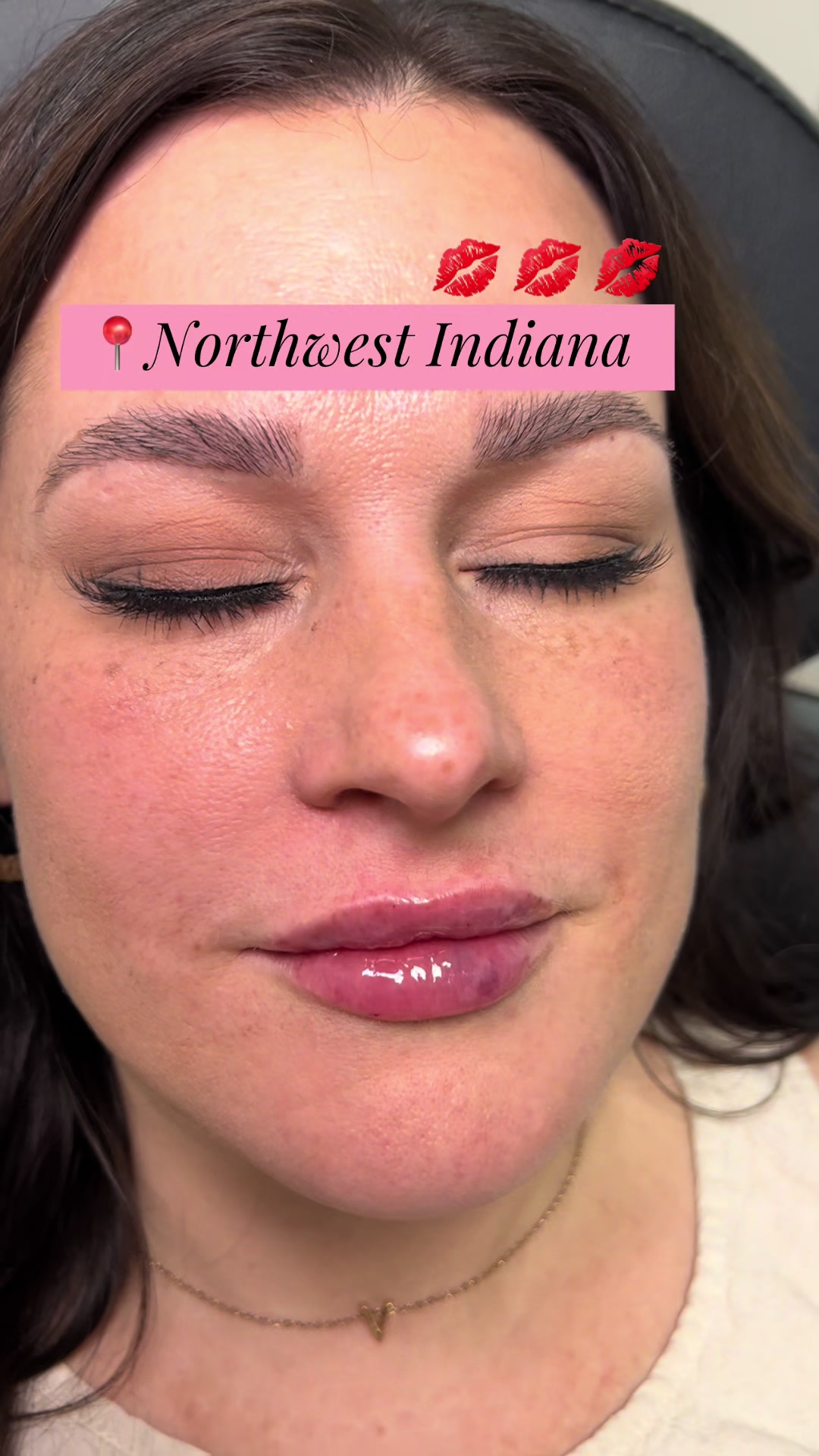 @Christy - NWI Aesthetic NP