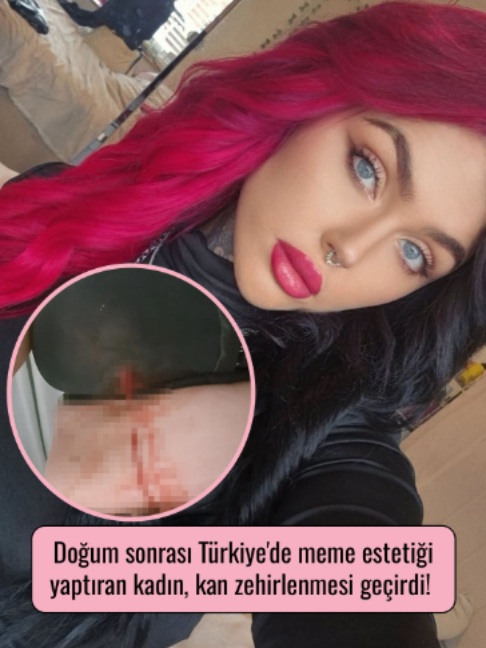 @Mynet Kadin