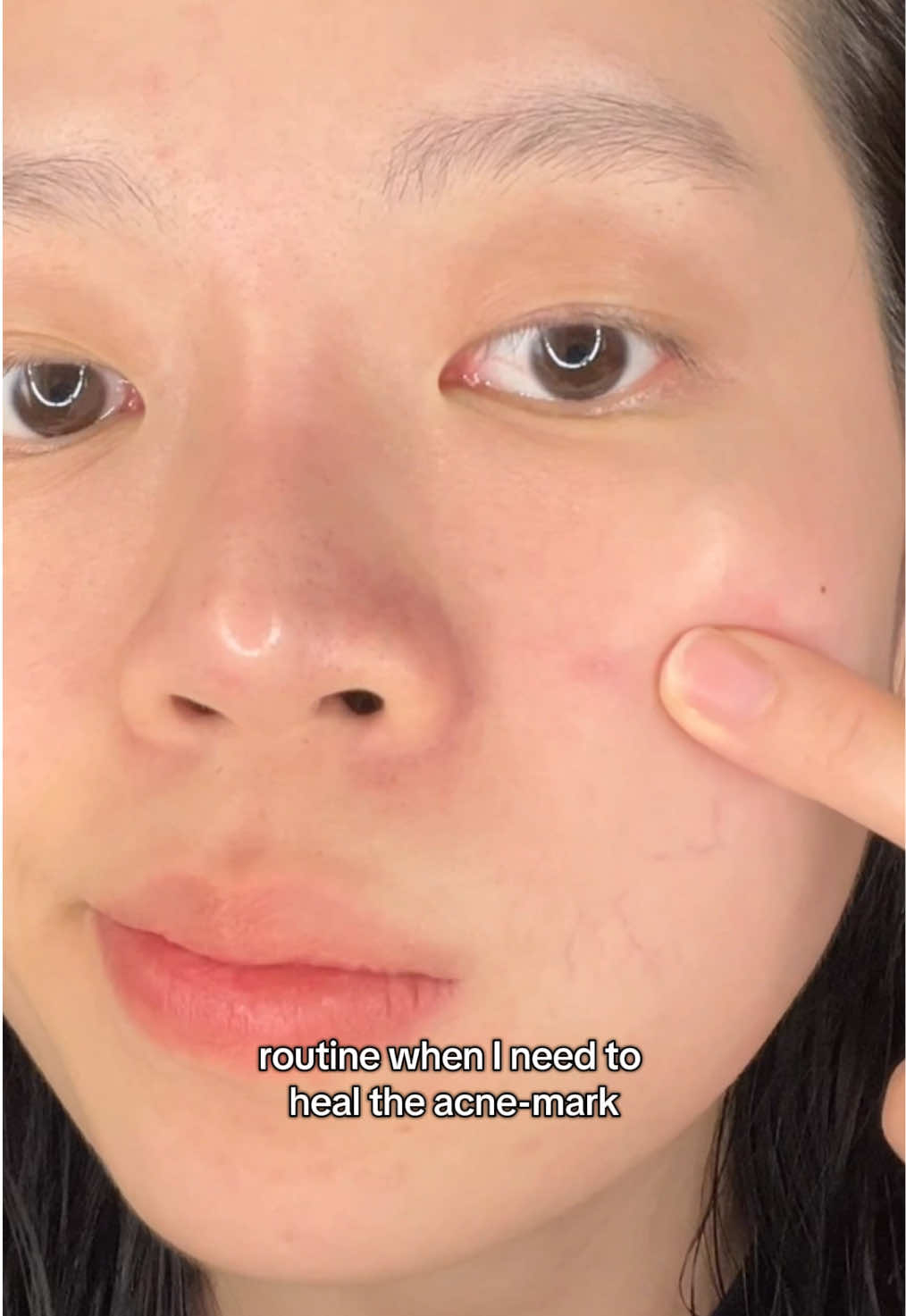 @Tracyskin