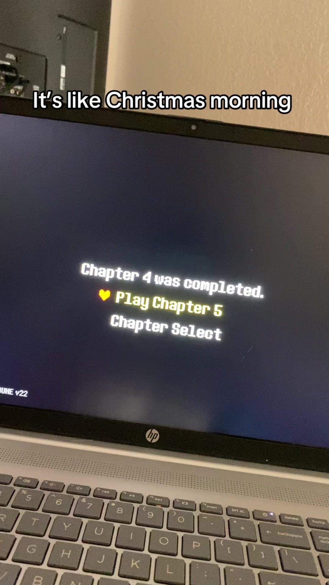 @Z0mbi3Gutz5