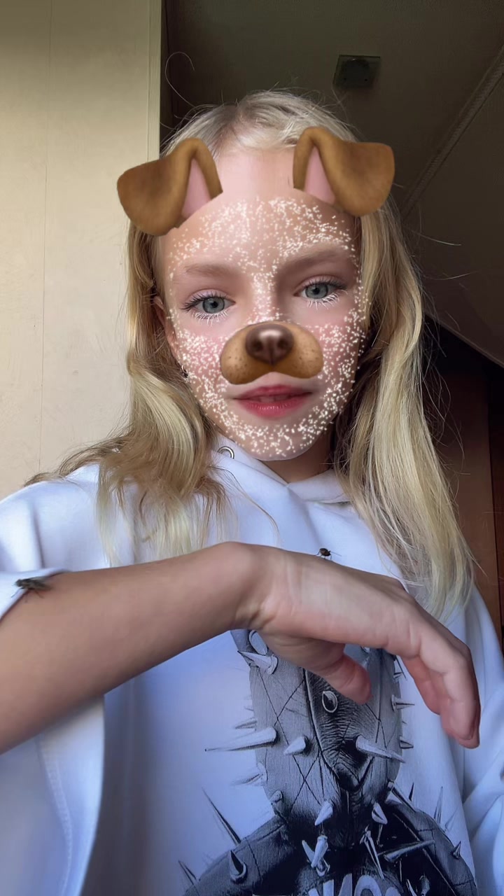 @#ᴛᴠɪsᴛɪᴋ||xx🐿️