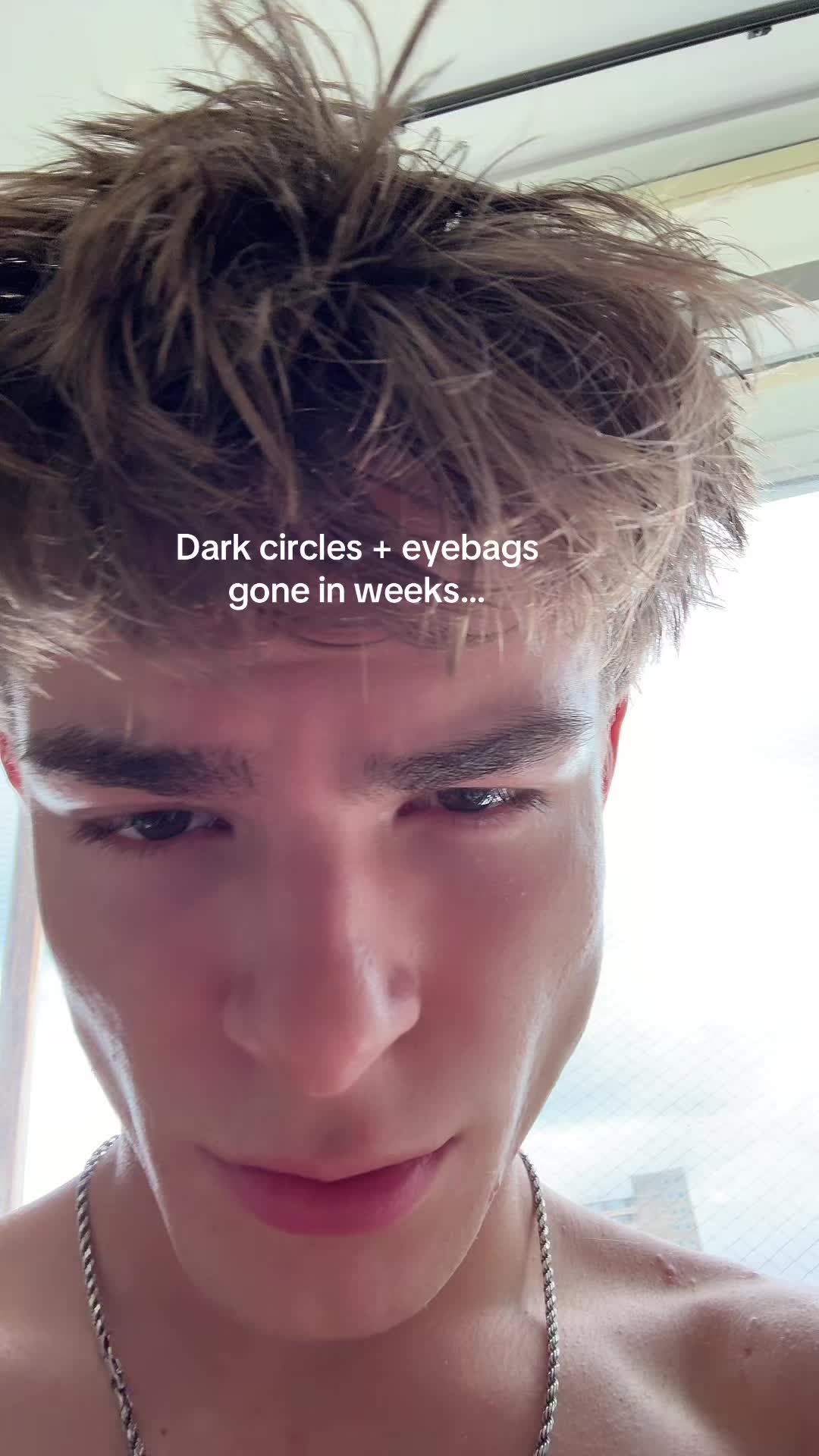 @Finn