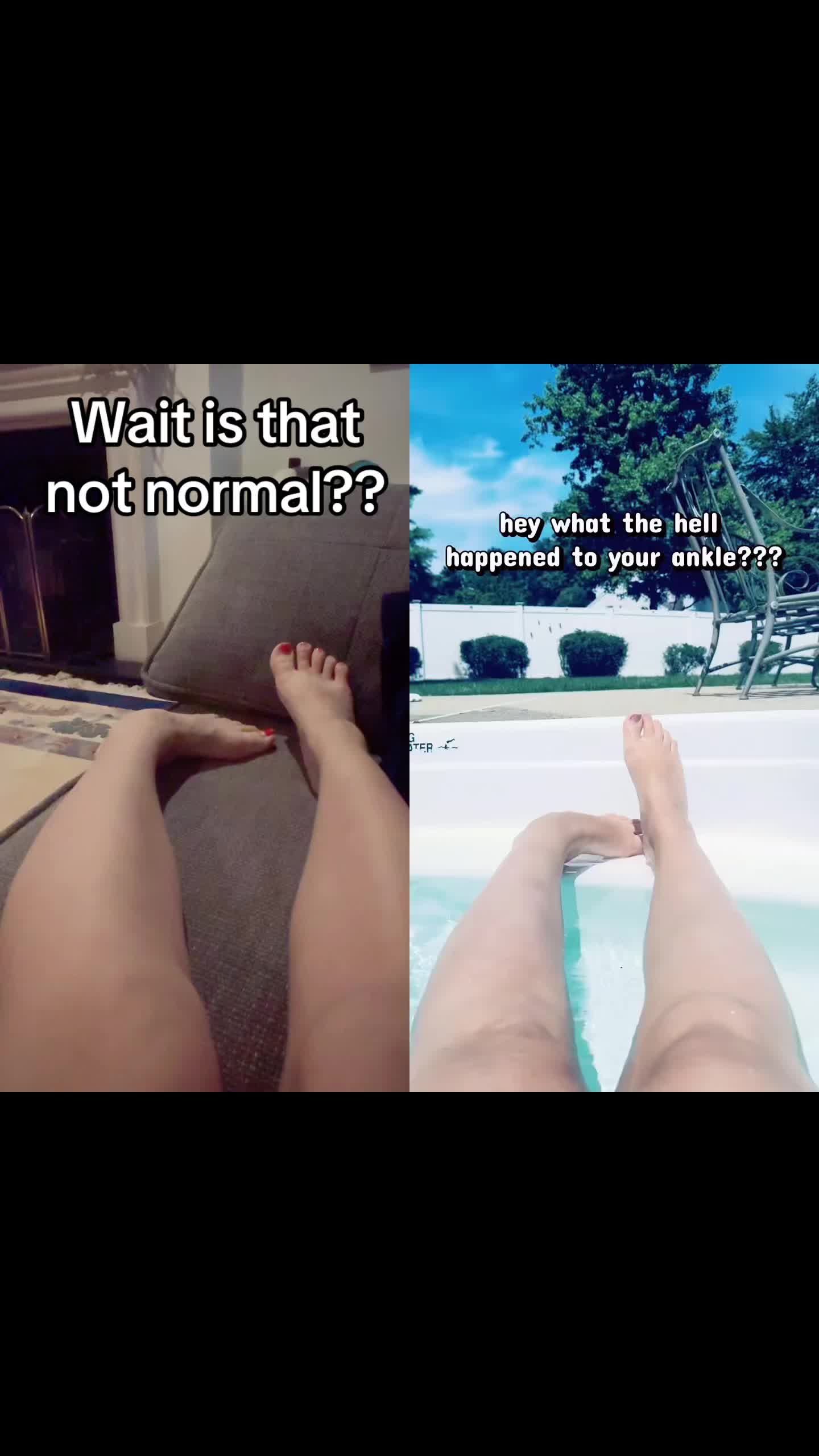@alt_audhd