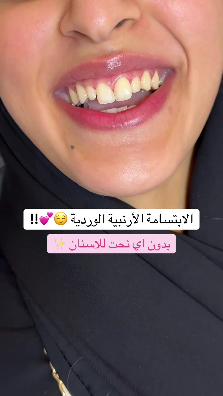 @Dr.lina_almasmoum