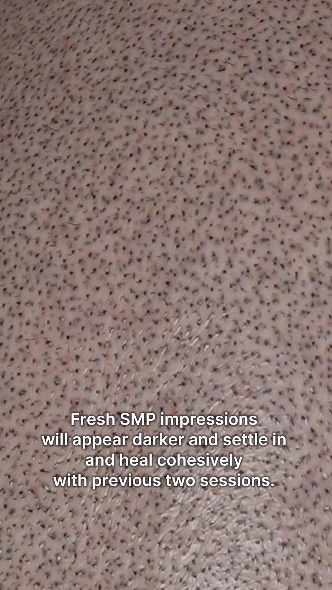 @Enhanced Scalp
