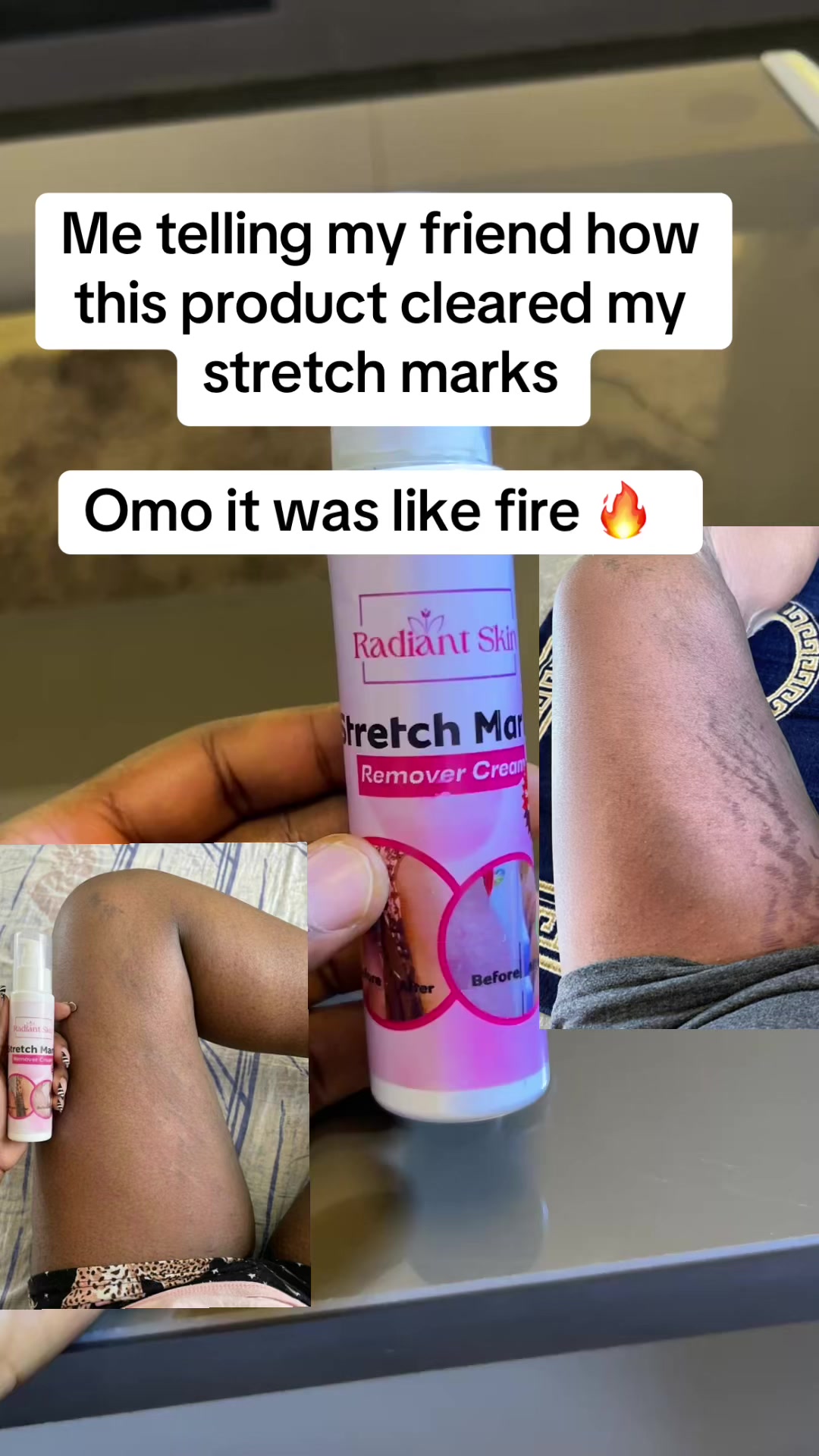 @Radiant skin