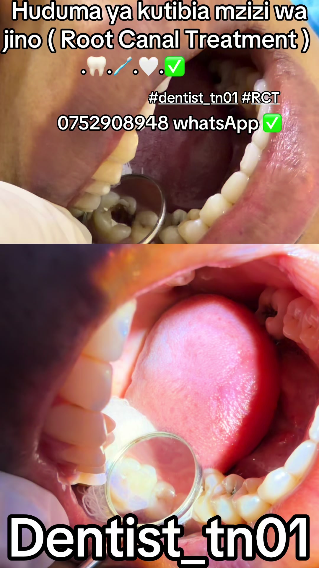 @Dentist_tn01