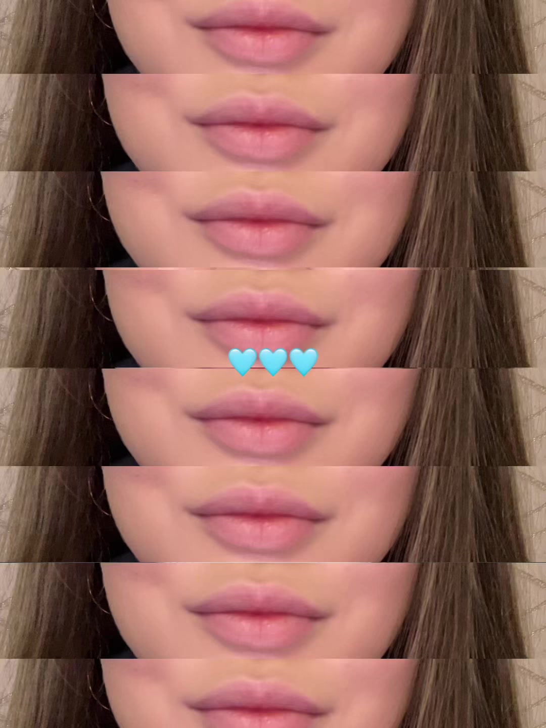 @𝕽