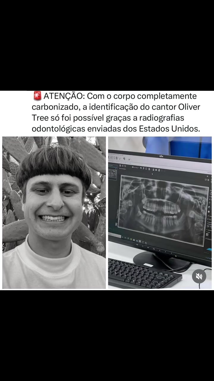 @FOFOCALIZANDO