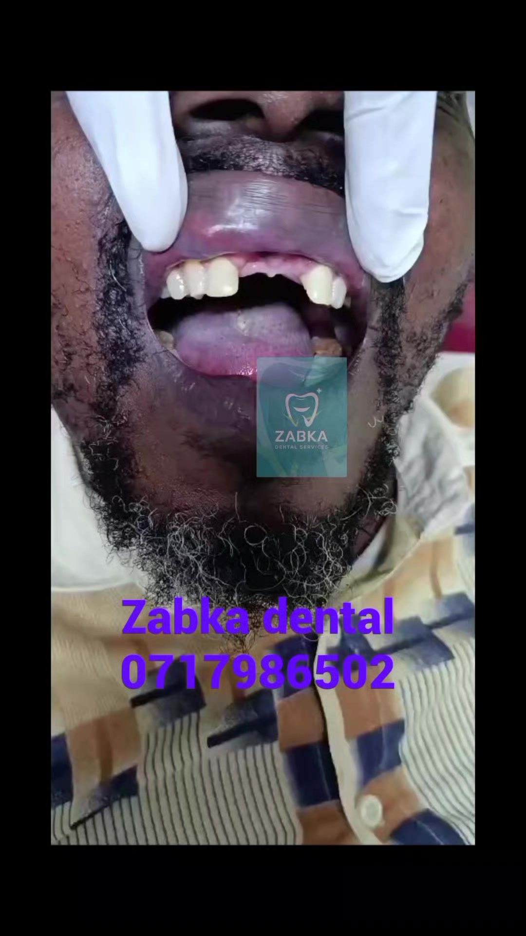 @Zabka Dental