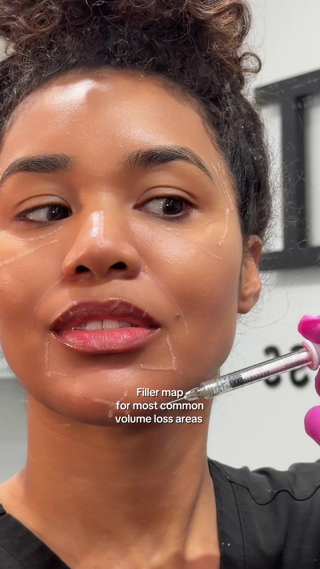@Botox Filler Skin Los Angeles